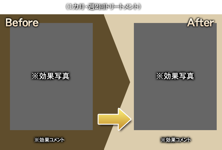 50代男性 A様（1カ月・週2回トリートメント）