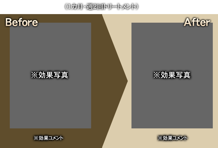 50代男性 A様（1カ月・週2回トリートメント）