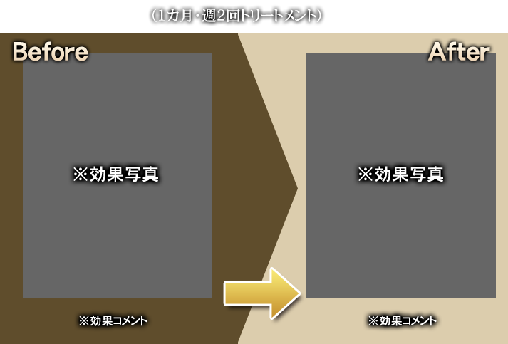 50代男性 B様（1カ月・週2回トリートメント）